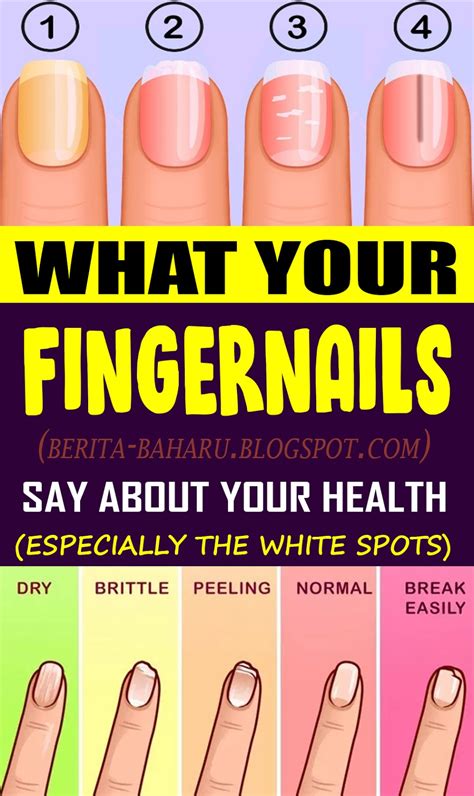 What Your Fingernails Say About Your Health