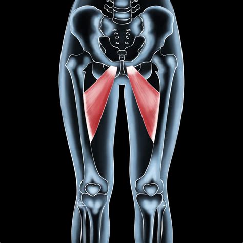 Get Adducted to Healing: Treating Longus Muscle Injuries