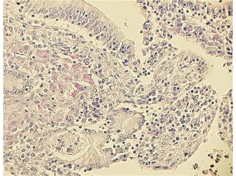 Ziehl-Neelsen Stain - Acid fast bacteria | Diapath