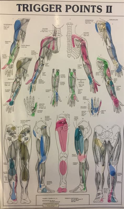 Trigger Points common in Colac | Corio Bay Sports Treatment Clinic Colac