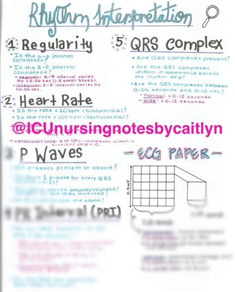 Basics of ECG Interpretation - Etsy