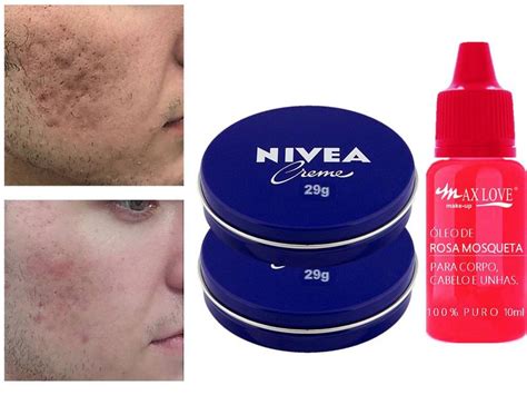 Nívea Lata Azul e Óleo de Rosa Mosqueta Tira Melasma e Rugas Max Love