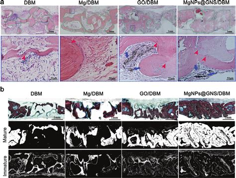 Histological Evaluation Of Regenerated Bone Tissue At 12 Weeks After Download Scientific