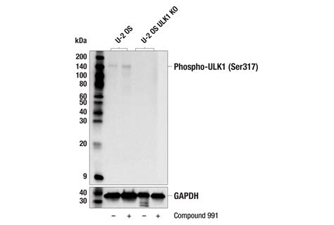 Phospho Ulk1 Ser317 F1z6c Rabbit Mab Cell Signaling Technology