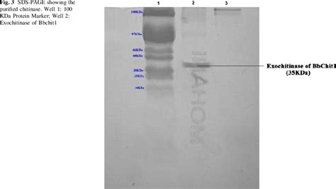 SDS PAGE Showing The Purified Chitinase Well 1 100 KDa Protein