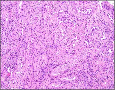 Biopsy Of Rectal Ulcer 2003 Magnification Hematoxylin And Eosin Download Scientific Diagram