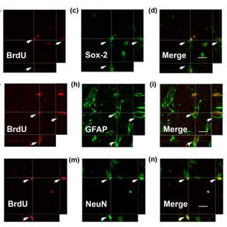 In Vitro Priming Of Svz Derived Adult Neural Progenitor Cells With