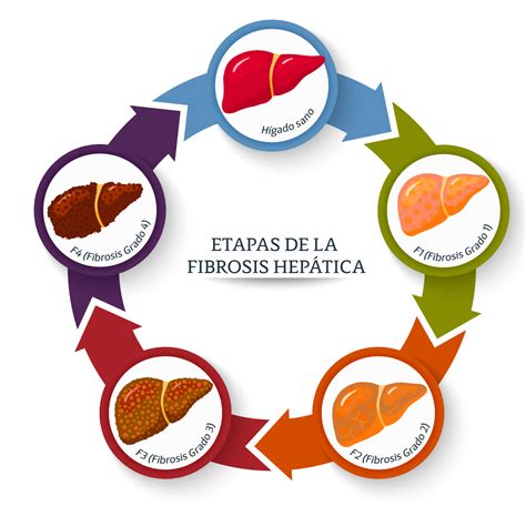 Médica Sur Fibroscan