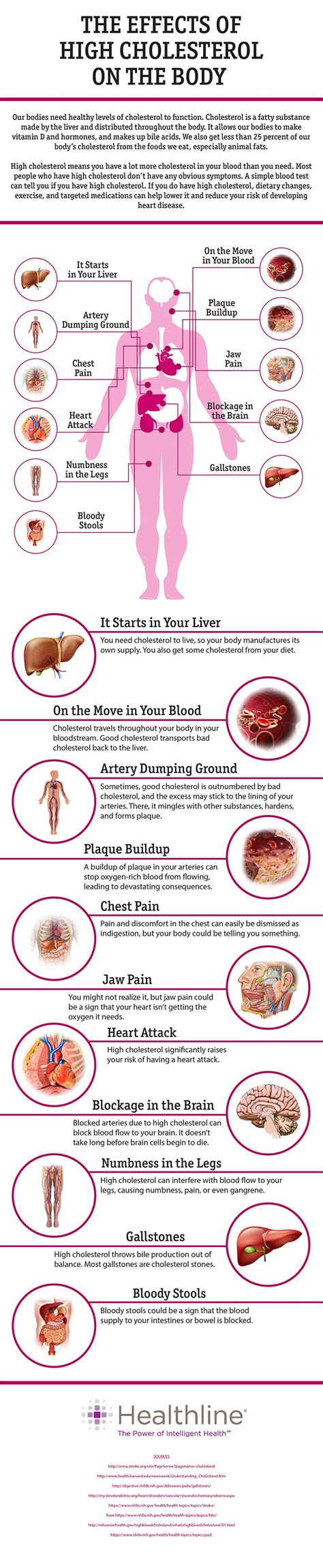 What High Cholesterol Does To Your Body Dr Sam Robbins