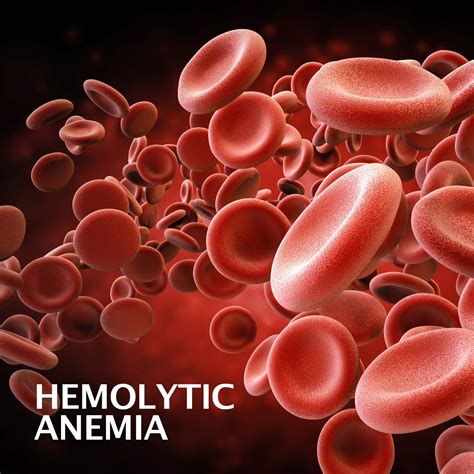 Hemolytic Anemia Gastroenterology Of Greater Orlando