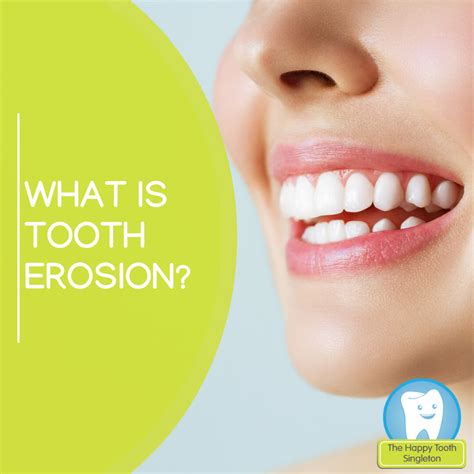 Tooth Erosion | The Happy Tooth Singleton