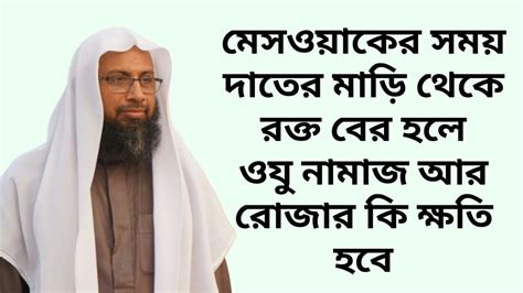 মেসওয়াকের সময় দাতের মাড়ি থেকে রক্ত বের হলে ওযু নামাজ আর রোজার কি ক্ষতি হবে Youtube