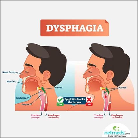 Elderly Swallowing Problems Complete Guide On Dysphagia