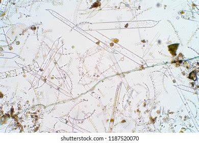 Marine Aquatic Plankton Under Microscope View Stock Photo (Edit Now ...