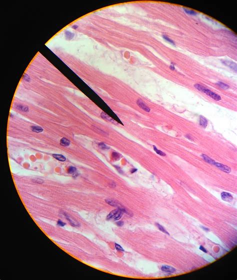 Histologia Do Tecido Muscular BRAINCP