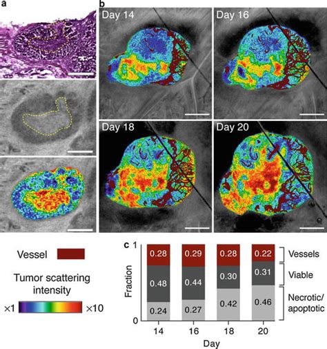 Optical Coherence Tomography In Cancer Imaging Ento Key