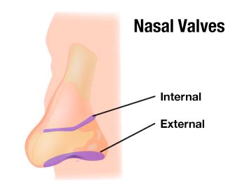 Chesapeake ENT Doctors Nasal Valve Collapse Specialist Baltimore