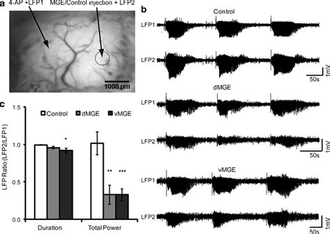 Medial Ganglionic Eminence Mge Transplants Attenuate Propagation Of