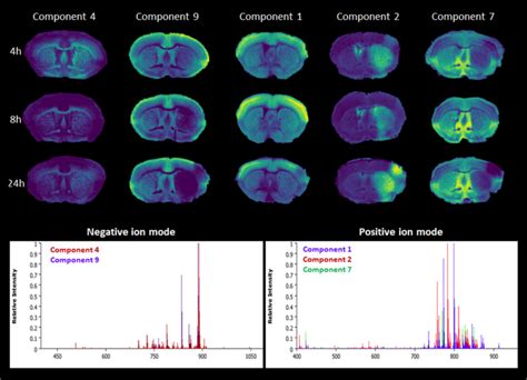 Distinguishing Core From Penumbra By Lipid Profiles Using Mass