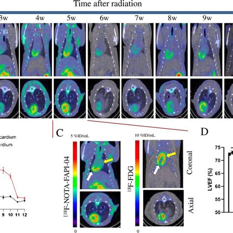 In Vivo Dynamic Imaging Of F Alf Nota Fapi Pet Ct A Dynamic