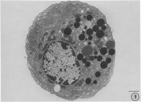 Electron micrograph of an isolated chief cell. The cell contains ...