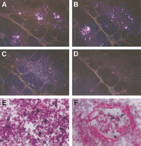 In Situ Hybridization Showing Expression Of Ip Mig And I Tac Mrna