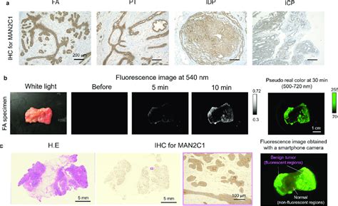 Application Of α Mannosidase Reactive Fluorescent Probe For Benign