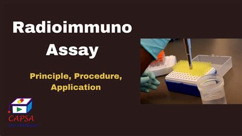 Radioimmuno Assay Or RIA YouTube