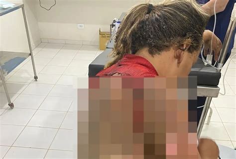 Homem é preso por jogar gasolina e atear fogo na companheira enquanto