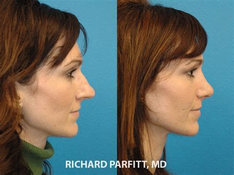 Facial Plastic Surgery Aesthetica Skin Health Center