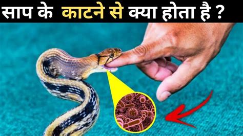 साप के काटने से क्या होता है What Happens When A Snake Bites