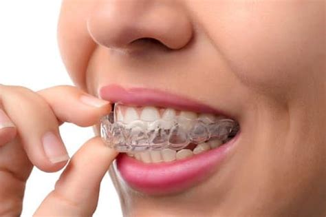 Find The Perfect Invisalign Dentist Tribeca Dentist Office