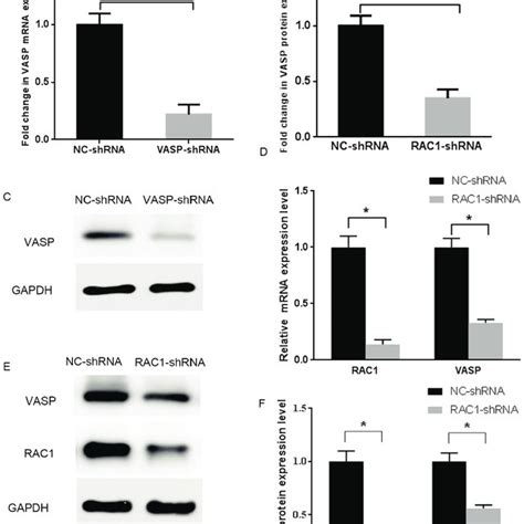 Rac And Vasp Mrna Expression In Tumor And Normal Tissue A Rac Mrna