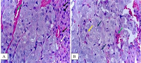 Zona fasciculata of the adrenal glands of rats from the experimental ...