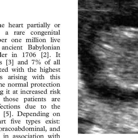 Transverse Sonogram At The Level Of The Chest Demonstrating Protrusion Download Scientific