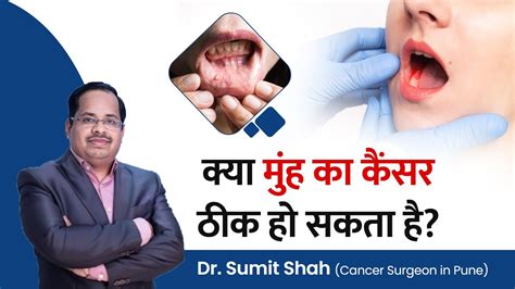 क्या मुंह का कैंसर ठीक हो सकता है Is Oral Cancer Curable Oral