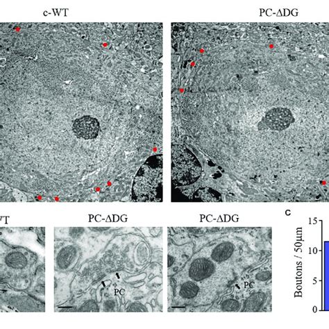 Gabaergic Synapse Elimination In Pc Mice A Representative Electron