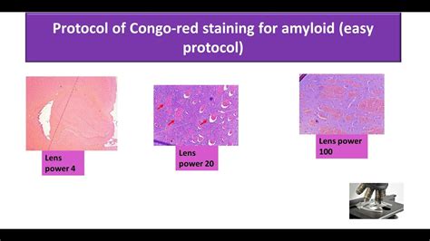 Congo Red Staining For Amyloid Easy Protocol Youtube