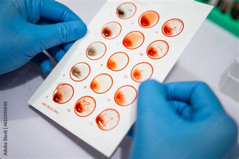 Hand Wearing Rubber Gloves Holding Test Paper When Testing Blood Types