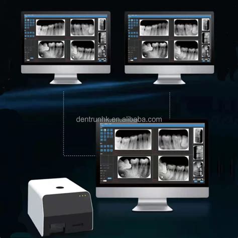 Dental X Ray Intraoral Digital Imaging Phosphor Plate Scanner