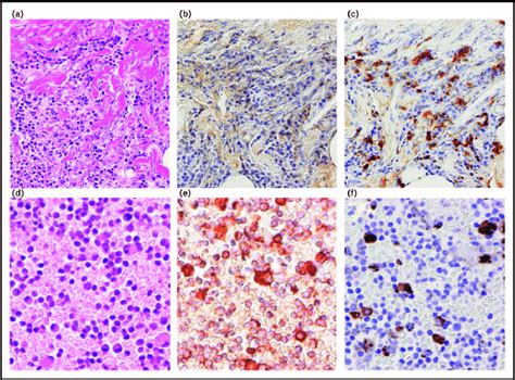 Histopathological Features Of The Parietal Pleura A C And Pleural