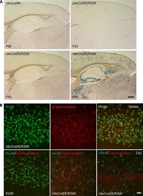 Characterization Of Cre Recombinase Expression In Ubc Cre Ert Mice