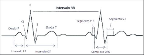 Electrocardiographic Tracing With Its Waves Segments And Intervals