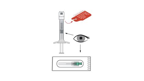 Administration And Dosing Schizophrenia Injection Uzedy™ Risperidone