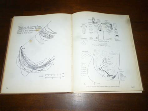 Atlas Of Human Sex Anatomy By Dickinson Robert Latou Good Hardcover