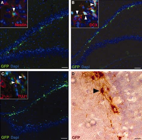 Grafted Neuronal Precursor Cells Differentiate And Integrate In Injured