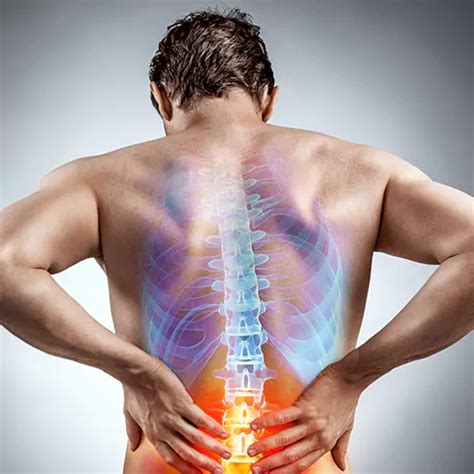 Herniated Disc Symptoms Causes Diagnosis And Treatments Cmw