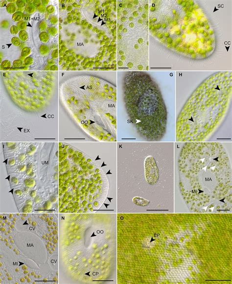 Morphological details of the Paramecium bursaria species complex from ...