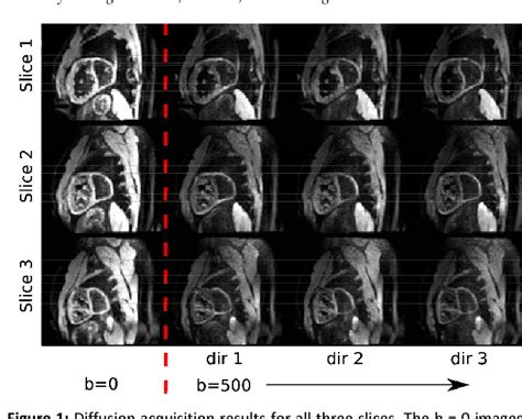 Figure 1 From In Vivo Diffusion Tensor Imaging Of The Systemic Right