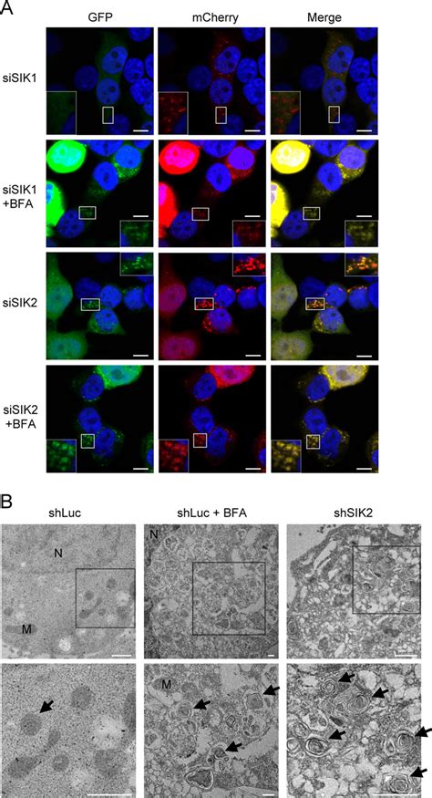 SIK2 Is Essential For Autophagosome Processing A HEK293T Cells Were